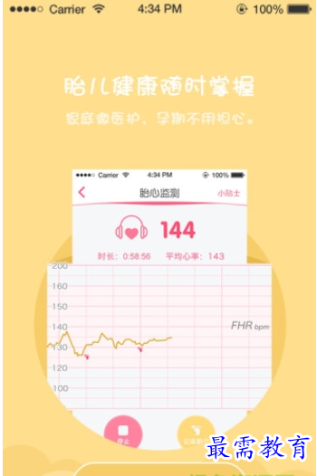 1661763082121382.png image.png