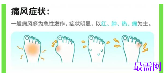 1764832100104380.png image.png